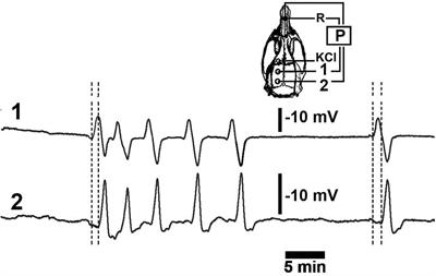 Stereological Analysis of Early Gene Expression Using Egr-1 Immunolabeling After Spreading Depression in the Rat Somatosensory Cortex